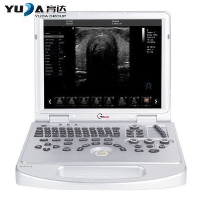 Notebook Full Digital Ultrasound Scanner Notebook Full Digital Ultrasound Scanner