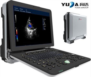 15 palec LED prenosnik barva doppler ultrazvok